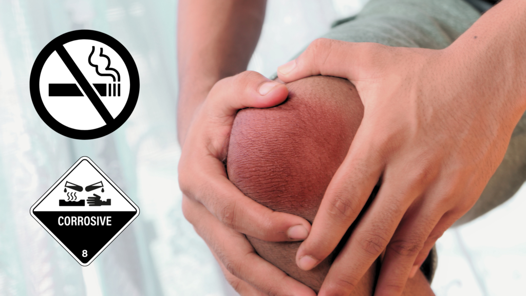 a picture of a knee being very sore, either from gout, osteoarthritis, or osteoperosis